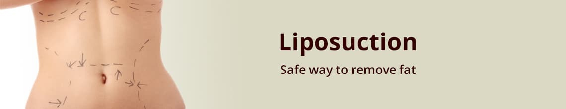 rhinoplasty nose job surgery