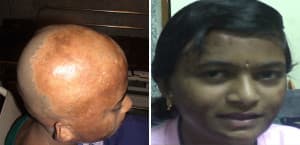 nose job cost